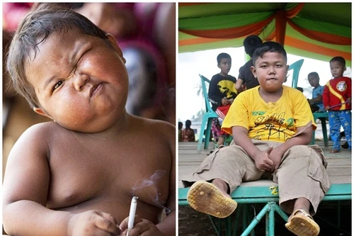 Cậu bé 2 tuổi từng hút 40 điếu thuốc lá/ngày giờ ra sao?