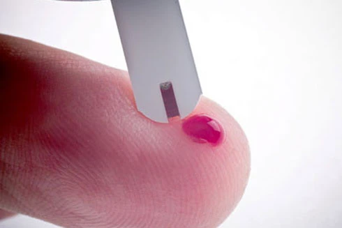 Có thể tự xét nghiệm HIV tại nhà