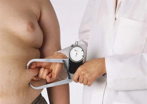 Nghiên cứu mới về khả năng ung thư của những người béo phì