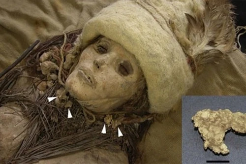 Tìm thấy pho mát trên người xác ướp 3.600 tuổi