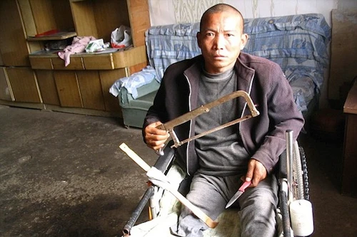 Người đàn ông tự cưa chân vì không có tiền đi viện