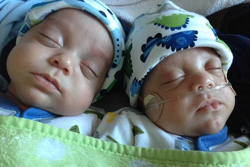 Khó tin: Cặp song sinh chào đời...cách nhau 39 ngày 