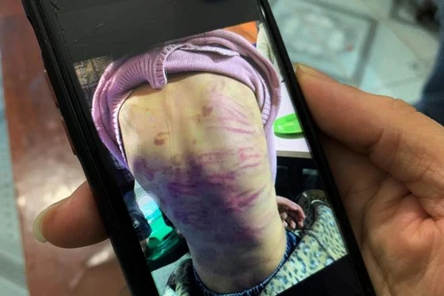 [Tin nhanh sáng 21-2-2021] Khẩn trương xác minh vụ bạo hành trẻ em ở quận Hà Đông