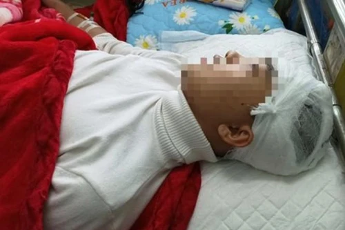 [Tin nhanh tối 6-3-2021] Bắt tạm giam nam sinh lớp 11 đánh bạn vỡ sọ não