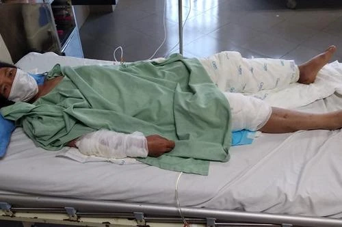 [Tin nhanh tối 24-2-2021] Chồng say rượu, tẩm xăng thiêu sống vợ