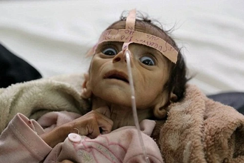 Cái chết ám ảnh của bé trai 5 tháng tuổi tố cáo tội ác chiến tranh