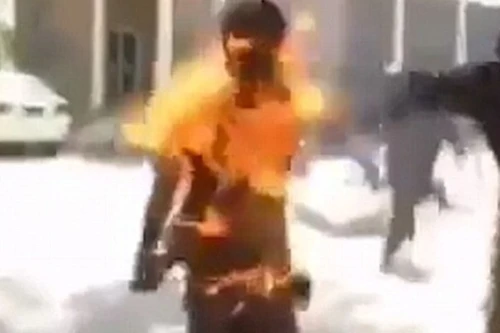 Điện thoại bốc cháy trong túi quần, thiêu chủ nhân