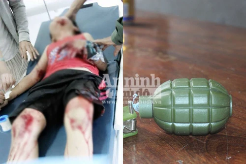 Nổ lựu đạn đồ chơi, hai cháu bé bị thương