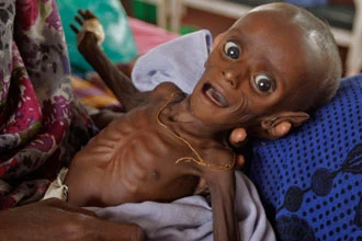 7 tháng tuổi nặng 3,8 kg – sống sót kỳ diệu