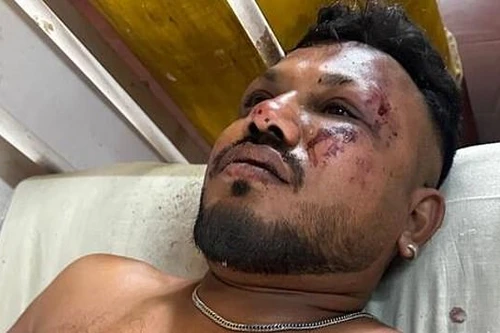 Hành khách duy nhất sống sót kể lại giây phút kinh hoàng khi máy bay gặp nạn ở Ấn Độ