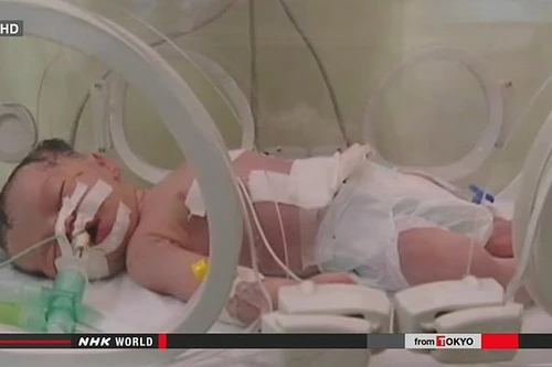 Gaza: Cứu sống con sản phụ chết do không kích 