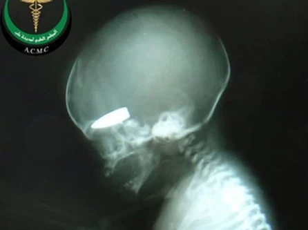 Syria bác tin dùng phụ nữ mang thai làm bia tập bắn