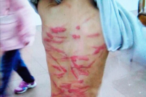 Không làm bài tập về nhà, bé 6 tuổi bị mẹ đánh tàn bạo