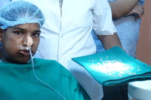 Lạ lùng cậu bé Ấn Độ mắc bệnh "u răng", có tới 232 chiếc răng 