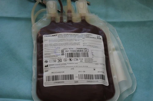 Châu Phi: Tràn lan "chợ đen" bán máu bệnh nhân Ebola sống sót