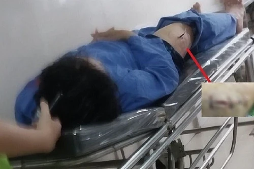 Lời khai bất ngờ của kẻ rút dao đâm cán bộ Thuế