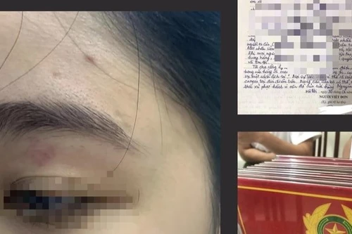 Giao cơ quan điều tra tiếp nhận vụ khách hàng tố cáo bị nhân viên cửa hàng bánh mì Nguyên Sinh hành hung 