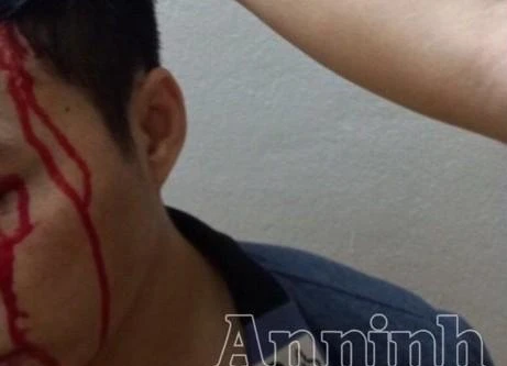 Con trai mua tiết lợn dàn dựng bị bắt cóc, tống tiền mẹ có phạm tội cưỡng đoạt tài sản?