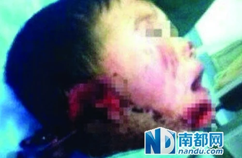 Trung Quốc: Một bé trai bị hành hung