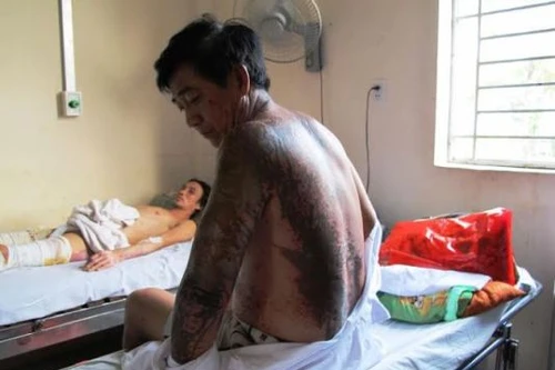 Vô cớ bị tạt a xít lúc đi tập thể dục lúc rạng sáng