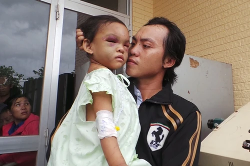 Cha ruột bé 4 tuổi bị bạo hành ở Bình Dương đến nhận con