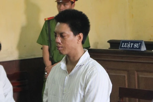 Gã chồng giết chết vợ hờ ra tòa với khuôn mặt đầy sẹo vì bị bỏng axit