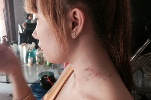 Nữ chủ tiệm tóc mưu trí, tay không chống trả tên cướp có dao