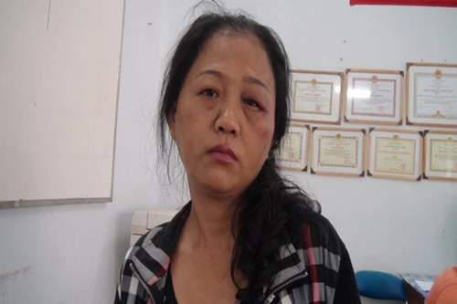 Bắt băng dàn cảnh móc tài sản của khách nước ngoài