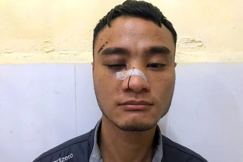 Ngựa quen đường cũ