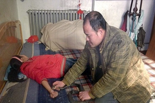 Con gái suýt chết vì cha dại dột cho rắn độc cắn tay để trị bệnh