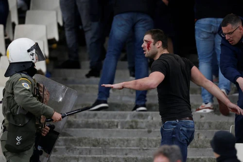 [ẢNH] Cổ động viên vỡ đầu chảy máu trên khán đài ngập khói bom xăng, pháo sáng