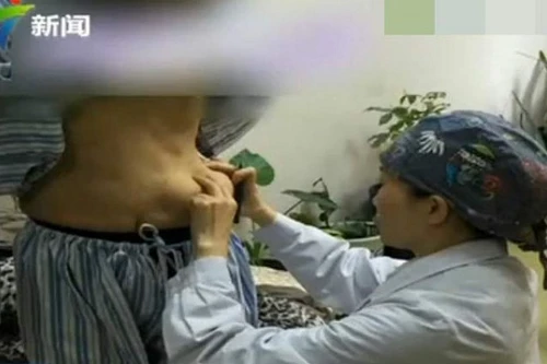 Nhập viện vì "ngực giả"... trôi xuống bụng