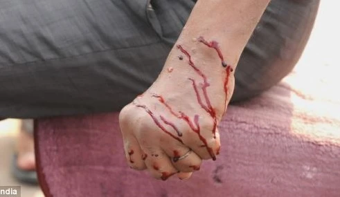 Kỳ quặc chuyện dùng dao lam rạch người để chữa bách bệnh