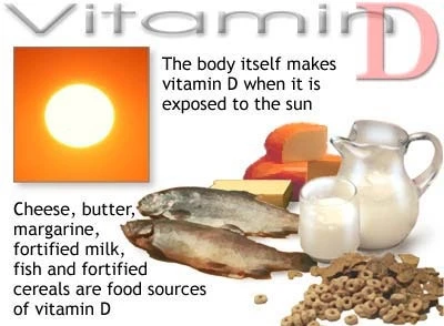 Thiếu hụt vitamin D do béo phì