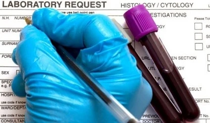 Ung thư vòm họng gia tăng đột biến do... "yêu" bằng miệng