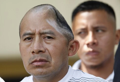 Được bồi thường 58 triệu USD vì bị đánh vỡ hộp sọ