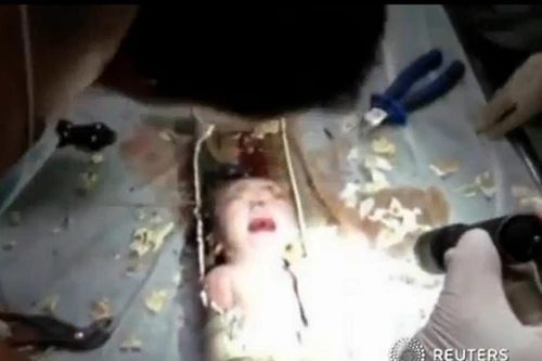 Giải cứu bé sơ sinh từ đường ống… bệ xí