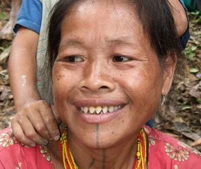 Răng càng nhọn, càng được coi là phụ nữ đẹp