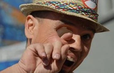 Làm xiếc trên khuôn mặt biến dạng vì ung thư