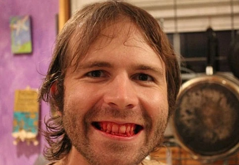 Người đàn ông nghiện ăn thịt sống