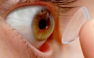 Cô gái 18 tuổi suýt bị mù mắt vì kính áp tròng