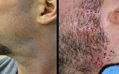 Phẫu thuật thẩm mỹ không như ý, quay ra "xử" y tá