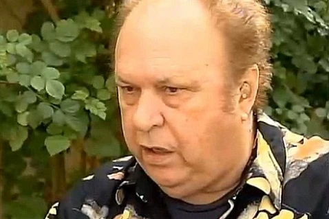 Dịch não chảy qua mũi suốt 18 tháng, bệnh nhân không hay biết