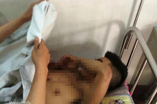 Khởi tố đối tượng nổ mìn sát hại người yêu