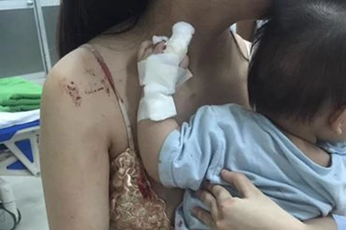 Hốt hoảng cảnh chuột cắn "nát tay" bé gái khi đang ngủ