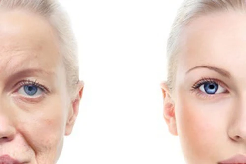 Biến thể gene khiến bạn già hơn tuổi thật