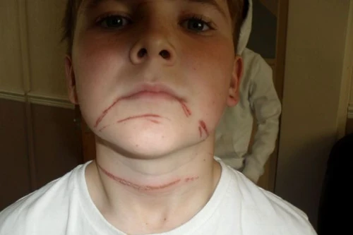 Suýt đứt đầu vì một trò đùa vô hại