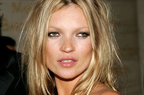 Kate Moss bị liệt tạm thời vì rối loạn thần kinh