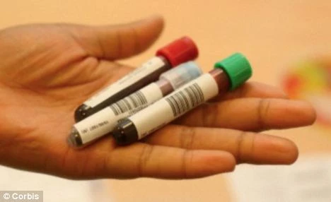 Lạc quan giúp giảm lượng cholesterol 