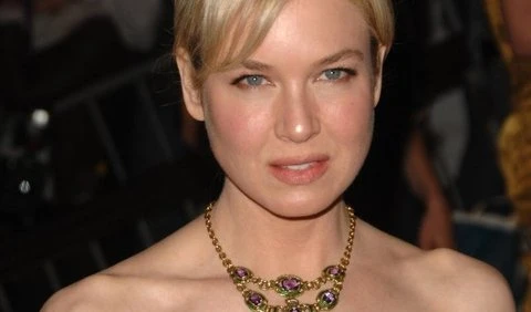 Nghi án Renee Zellweger lạm dụng botox